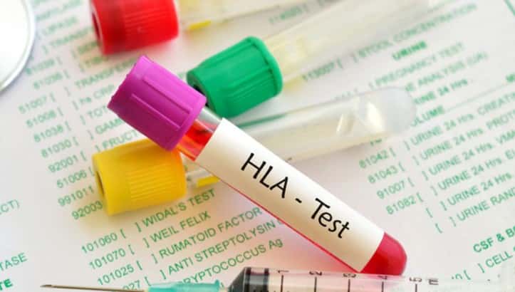 Nature: Ученые обнаружили ген, отвечающий за бессимптомное течение Covid-19