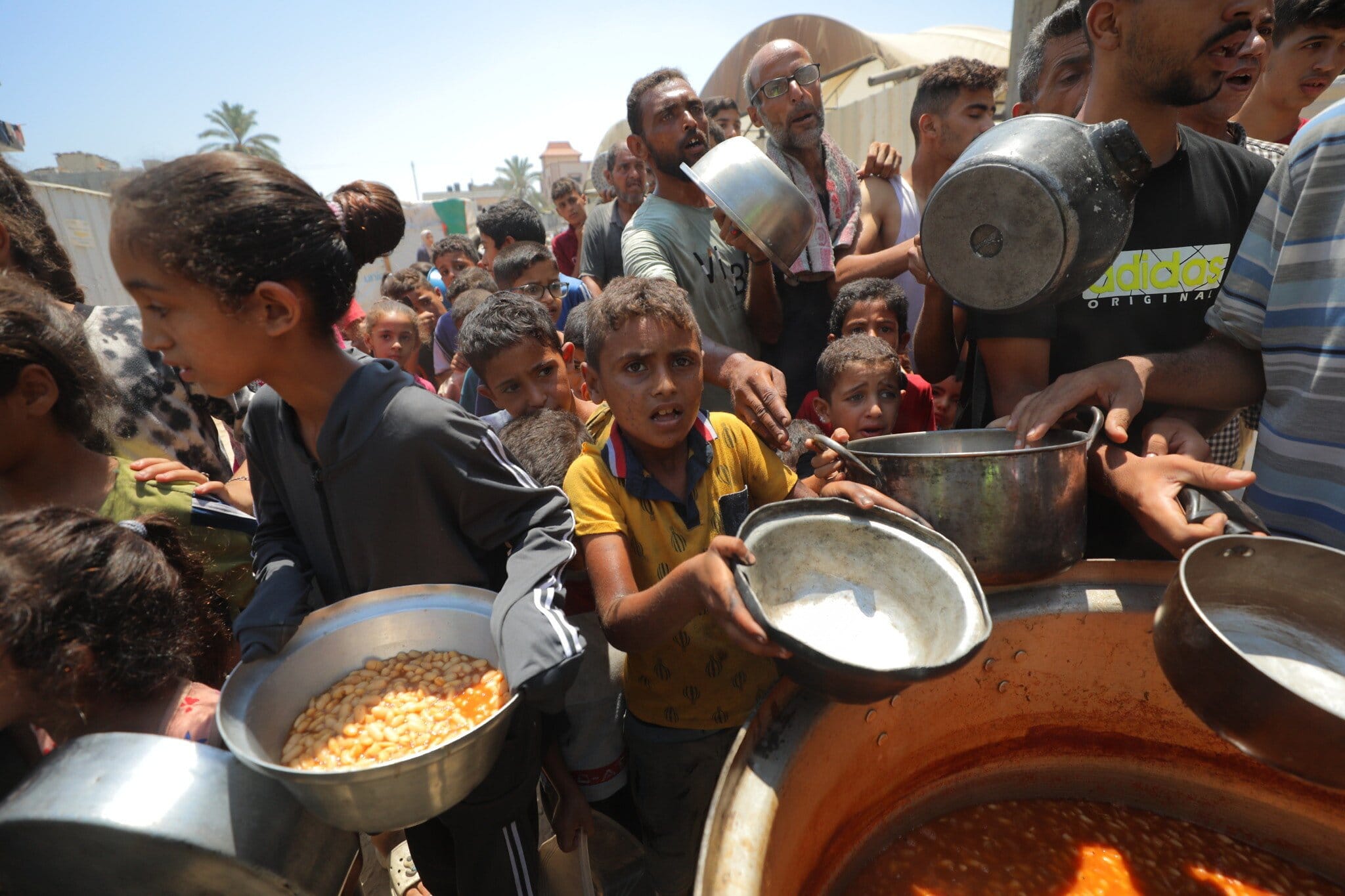 Starving children and the information war: What’s really happening in the Gaza Strip