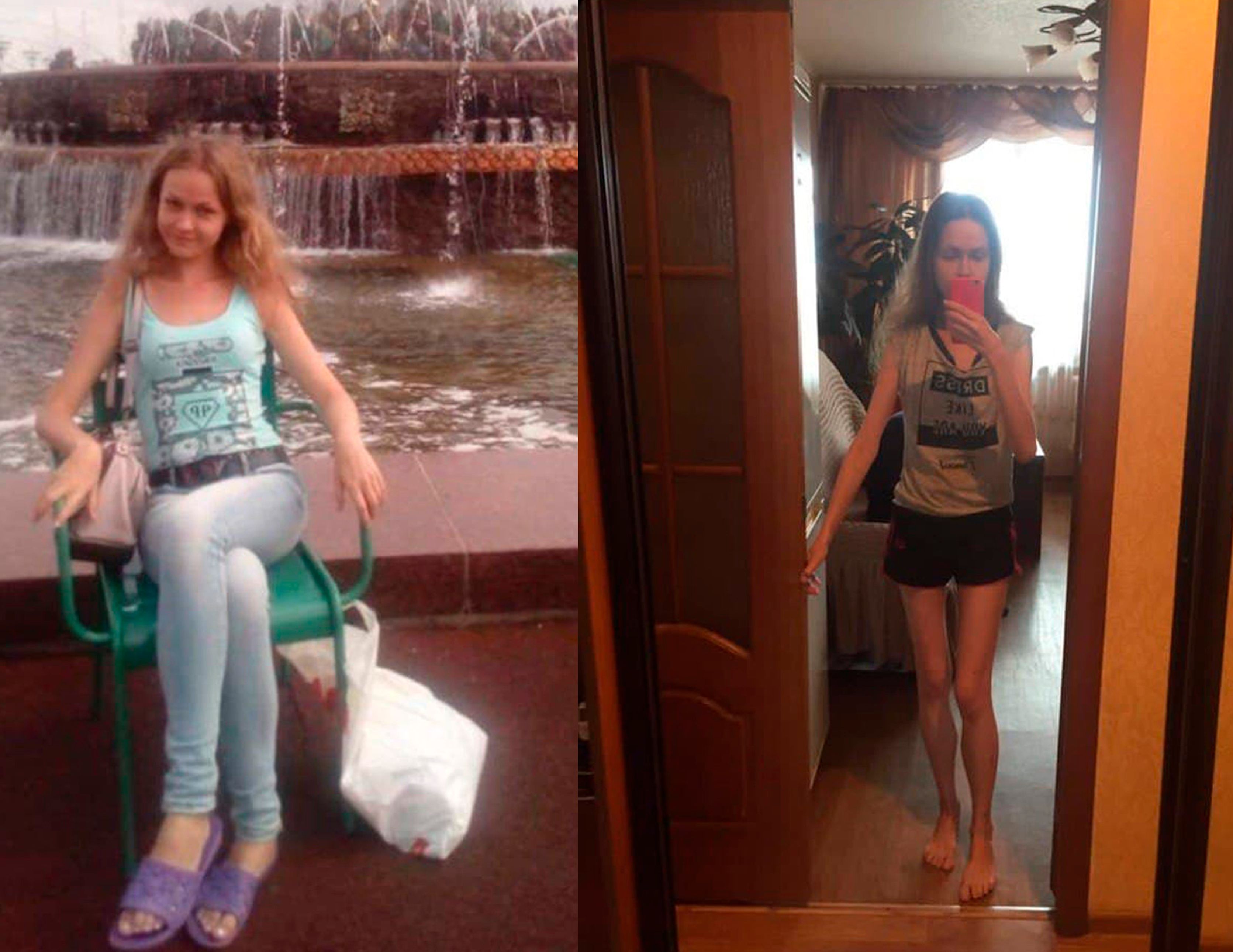Ekaterina before her illness and today